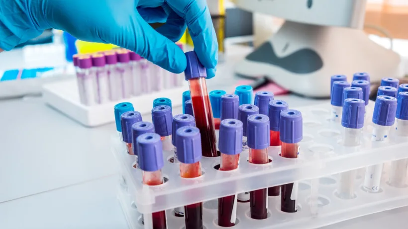 Ministerul Sănătății anunță: Testarea gratuită pentru hepatitele B și C, accesibilă tuturor românilor