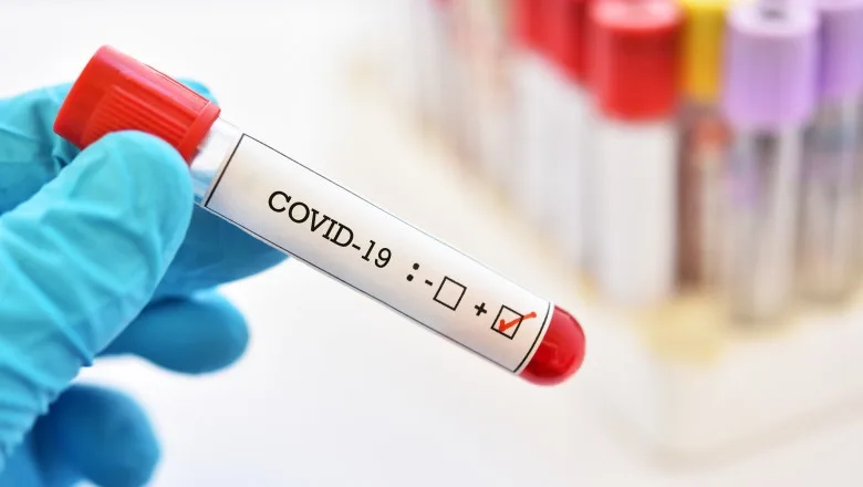 Focar de Covid-19 la un Centru de Dializă: 14 pacienți, infectați
