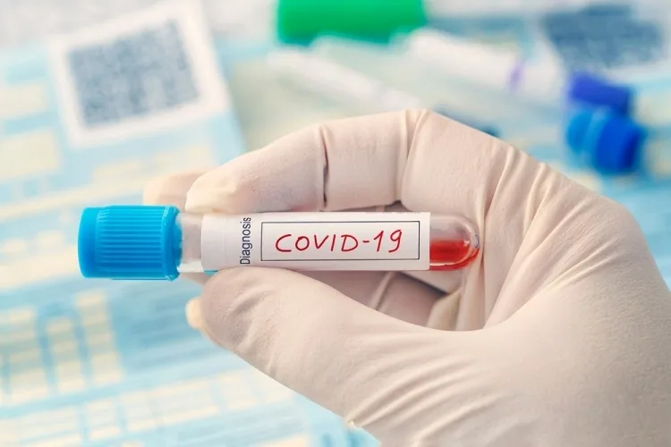 Uşoară scădere a numărului de infectări cu SARS-CoV-2