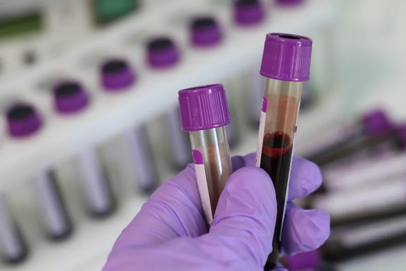 Studiu clinic de anvergură pentru depistarea a 50 de tipuri de cancer