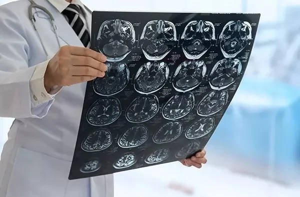 Peste 150 de milioane de adulți cu demență până în anul 2050