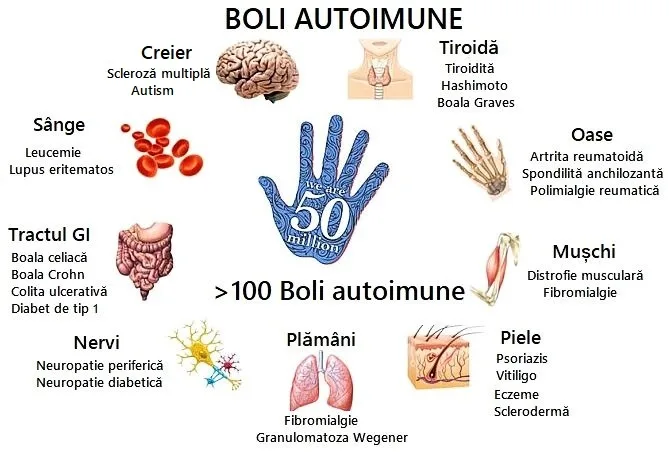 Tratament personalizat pe pacient pentru bolile autoimune
