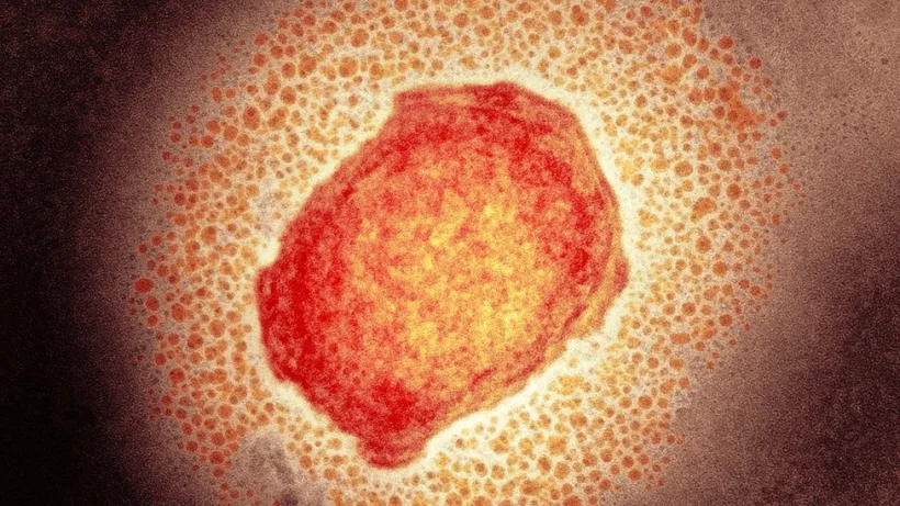 O nouă epidemie ”debarcă” în țările vest europene: "monkeypox"