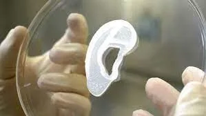 Primul implant de ureche imprimată 3D, realizată din celule umane vii