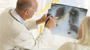 S-a lansat apelul pentru programul național de prevenire, screening, diagnostic și direcționare către tratament a pacienților cu tuberculoză